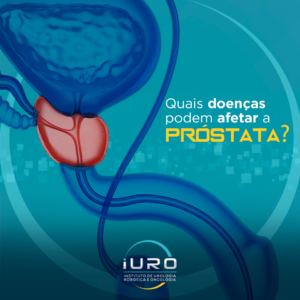 Quais Doenças Afetam a Próstata? – iURO Instituto de Urologia Robótica e Oncologia