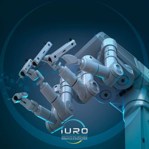 iuro-noticias-cirurgia-robotica-no-tratamento-cancer-prostata